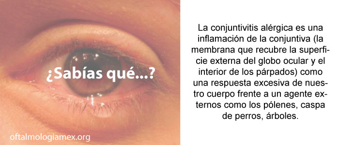 Conjuntivitis