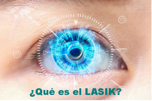 LASIK